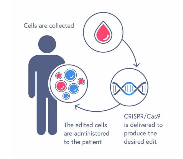 Proces leczenia CASGEVY obejmuje transfuzję zmodyfikowanych komórek macierzystych krwi. (Źródło: CRISPR Therapeutics)