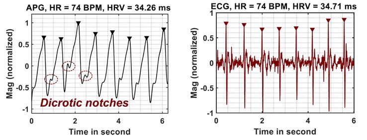 Odczyty APG wypadają korzystnie w porównaniu z odczytami EKG (Źródło obrazu: Google Research)