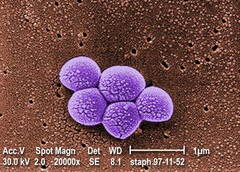 Integrated Biosciences odkrywa nową klasę antybiotyków skutecznych przeciwko opornym bakteriom MRSA. (Źródło: Public Health Image Library #9994)