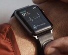 KardiaBand to opaska monitorująca EKG zaprojektowana dla zegarka Apple. (Źródło zdjęcia: Kardia)