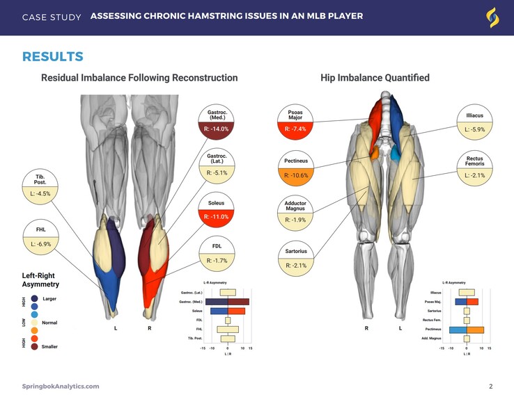 Raporty Springbok Analytics szczegółowo opisują poszczególne mięśnie za pomocą skanów 3D MRI. (Źródło: Springbok Analytics)
