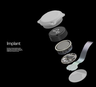 Różne elementy implantu Neuralink. (Źródło: Neuralink)