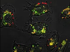 Dzięki sferycznym kwasom nukleinowym związek 5-fluorouracyl był 20 000 razy skuteczniejszy niż zwykle w badaniach na zwierzętach. (Źródło zdjęcia: Northwestern University)