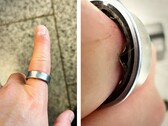 Samsung Galaxy Ring ze spuchniętą baterią zmusił użytkownika do udania się do szpitala. (Źródło zdjęcia: Zone of Tech)