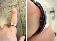 Samsung Galaxy Ring ze spuchniętą baterią zmusił użytkownika do udania się do szpitala. (Źródło zdjęcia: Zone of Tech)