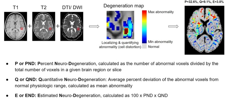 BrainSee może wykryć nieprawidłowe obszary mózgu na podstawie skanu MRI i dać lekarzom wynik wskazujący prawdopodobieństwo rozwoju choroby Alzheimera u pacjenta. (Źródło: Darmiyan)