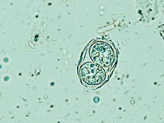 Toxoplasma gondii pokazana tutaj w swojej zakaźnej formie przypominającej jajo. (Źródło zdjęcia: Todorean Gabriel/iStock/Getty Images Plus)