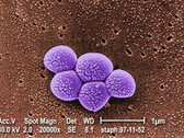 Integrated Biosciences odkrywa nową klasę antybiotyków skutecznych przeciwko opornym bakteriom MRSA. (Źródło: Public Health Image Library #9994)