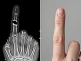 Bone Biologics składa wniosek patentowy na nowatorską technologię regeneracji kości (źródło obrazu: obraz ilustracyjny wygenerowany przez AI)