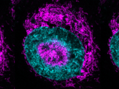 Zamknięta komórka nowotworowa (na zdjęciu) - mitochondria w kolorze magenta można zobaczyć gromadzące się na obrzeżach jądra w kolorze cyjanu i wewnątrz wgłębień jądrowych. (Źródło obrazu/zdjęcia: Rito Ghose i Fabio Pezzano/Centro de Regulación Genómica)