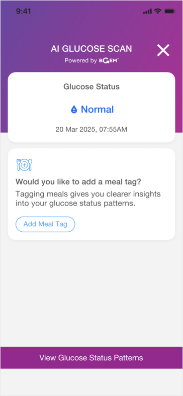 Inteligentny pierścień może być przydatny do odkrywania powiązań między niektórymi pokarmami a poziomem cukru we krwi użytkownika