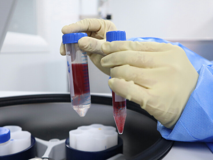 Laboratoria badania krwi znalazły się wśród usług NHS zakłócanych przez cyberatak na łańcuch dostaw Synnovis (źródło zdjęcia: Unsplash/Malcolm Choong)