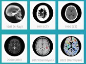 Oprogramowanie medycznej sztucznej inteligencji Darmiyan BrainSee może wcześnie wykrywać oznaki choroby Alzheimera. (Źródło: Darmiyan)