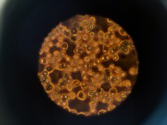 Komórki krwi pod mikroskopem (źródło zdjęcia: ThisisEngineering via Unsplash; przycięte)