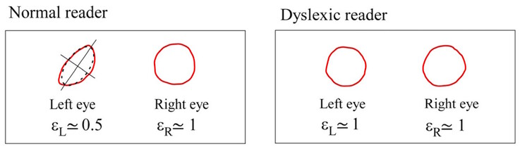 Centroidy Maxwella różnią się symetrią u osób zdrowych, ale są podobne u osób z dysleksją. (Źródło zdjęcia: DOI 10.3390/brainsci13101478) 